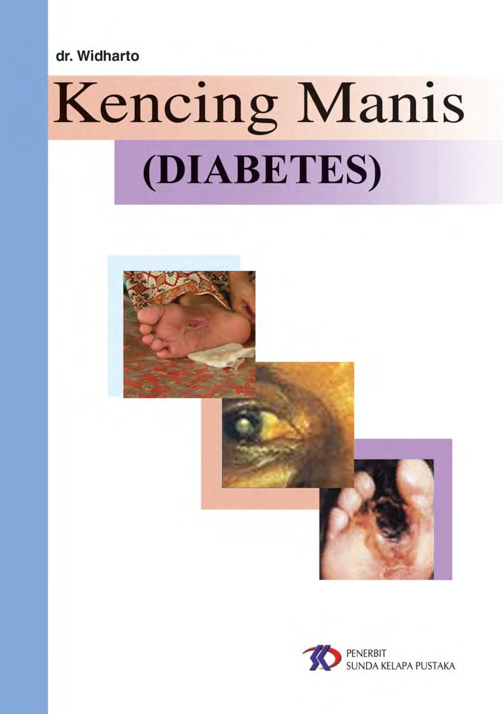 Kencing manis (diabetes) [sumber elektronis]