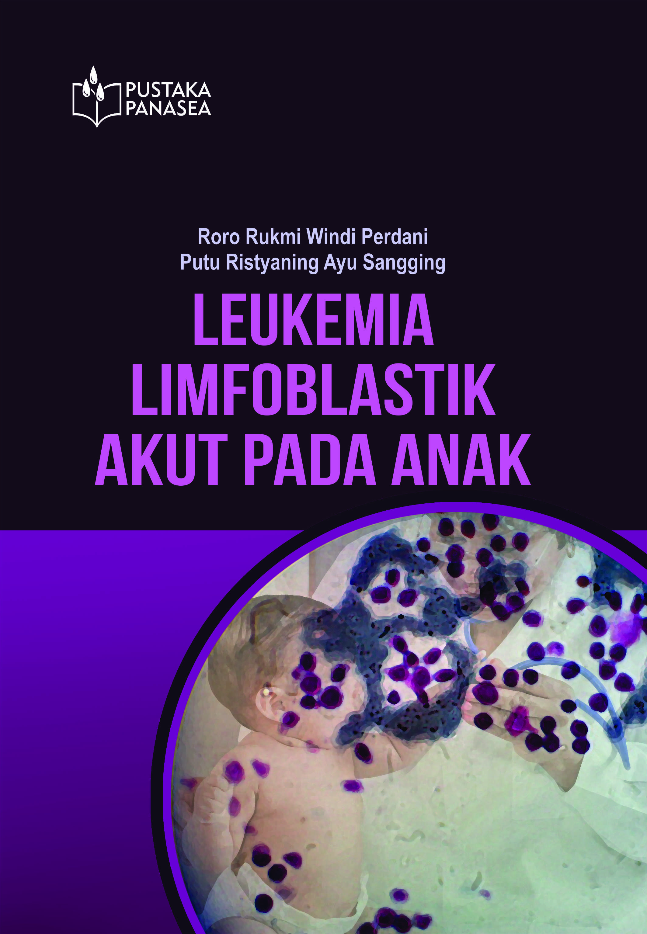 Leukemia limfoblastik akut pada anak