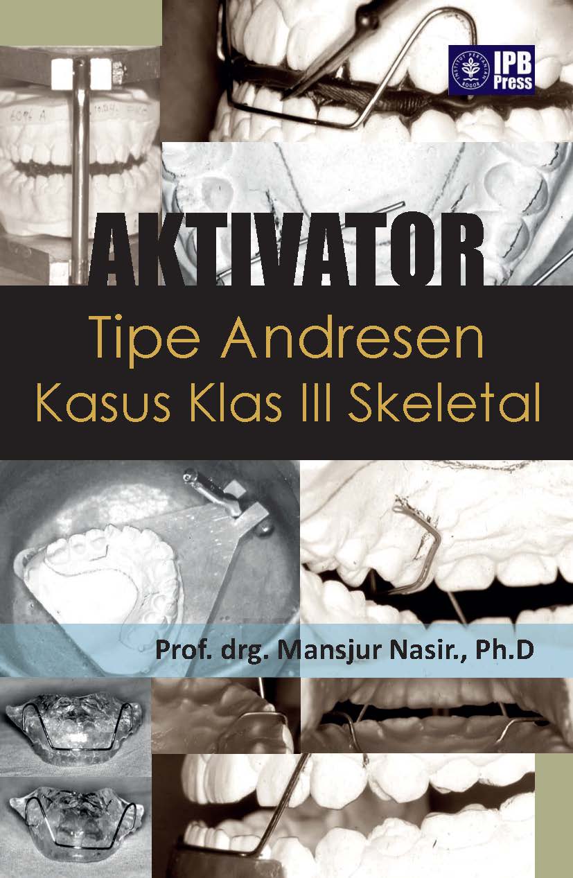 Aktivator tipe andresen kasus klas III skeletal [sumber elektronis]